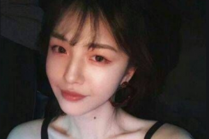 懷化愛爾眼科醫(yī)院鄭華整形價格表附切開雙眼皮案例展示