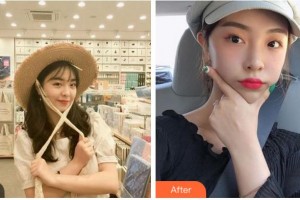 寧波陳標(biāo)新整形美容醫(yī)院裴峻晟整形價格表附熱拉提案例展示