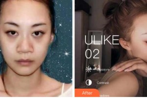 寧波煥嬌醫(yī)療美容門診部王惠梅整形價(jià)格表附鼻部綜合案例展示