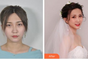 寧波胡繼來(lái)醫(yī)療美容診所黃雄飛整形價(jià)格表附眼部綜合案例展示