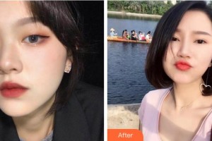 寧波鄞州眼科醫(yī)院朱佰傳整形價(jià)格表附眼部綜合案例展示