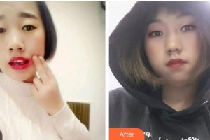 寧波牙博士口腔醫(yī)院金勇和整形價(jià)格表附根管調(diào)節(jié)案例展示