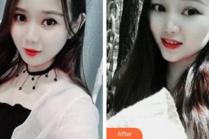 寧波市眼科醫(yī)院吳善君整形價(jià)格表附牙齒隱形矯正案例展示