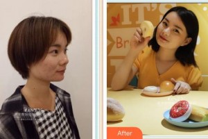 寧波千口百惠口腔門診部程海標(biāo)整形價(jià)格表附牙齒隱形矯正案例展示