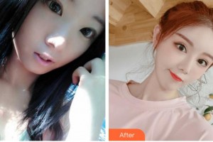 溫州友好醫(yī)院整形美容中心陳祥整形價格表附眼部綜合案例展示