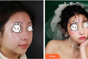 溫州和平整形醫(yī)院嚴(yán)園園整形價(jià)格表附激光祛斑案例展示