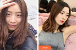 溫州芘麗芙美容醫(yī)院劉永楊整形價(jià)格表附埋線雙眼皮案例展示