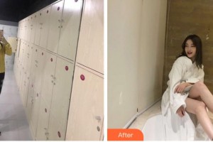 溫州伯思立醫(yī)院醫(yī)療美容科劉李娜整形價格表附吸脂案例展示