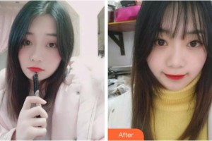 溫州醫(yī)科大學(xué)附屬口腔學(xué)院魏利敏整形價格表附牙齒隱形矯正案例展示