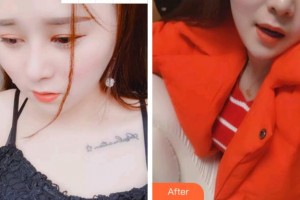 溫州醫(yī)科大學(xué)附屬口腔學(xué)院梅麗琴整形價格表附超聲波潔牙案例展示