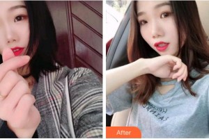 溫州王曉峰口腔醫(yī)院蘇楊整形價格表附牙齒隱形矯正案例展示