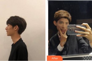 溫州拜博口腔醫(yī)院賈道真整形價格表附牙齒隱形矯正案例展示