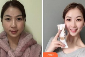 嘉興華山醫(yī)療美容醫(yī)院倪曉云整形價格表附激光祛斑案例展示