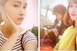 湖州金鉑利口腔門診部秦新杰整形價格表附美白貼片案例展示