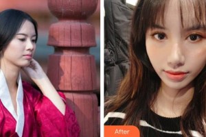 湖州長興愛爾眼科醫(yī)院范玉燕整形價格表附眼部綜合案例展示