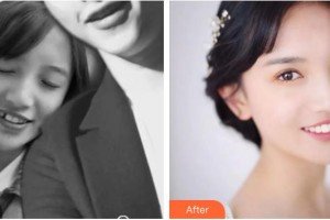 湖州徐兆桂牙科診所徐兆桂整形價格表附金屬托槽矯正案例展示