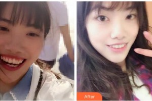 紹興德維口腔醫(yī)院韓志夏整形價(jià)格表附牙齒陶瓷矯正案例展示