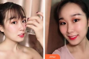 紹興博雅口腔醫(yī)院樊云霞整形價(jià)格表附牙齒隱形矯正案例展示