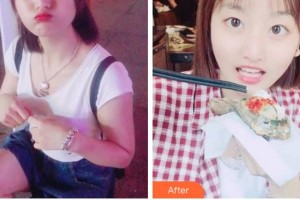 紹興市口腔醫(yī)院王曉英整形價(jià)格表附美白劑美白牙齒案例展示