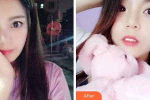 紹興京韓口腔醫(yī)院薛敏整形價(jià)格表附牙齒隱形矯正案例展示