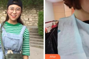 紹興京韓口腔醫(yī)院柳二弼整形價格表附牙齒陶瓷矯正案例展示