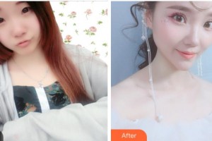 金華康美醫(yī)療美容綜合門診部林子豪整形價格表附眼部綜合案例展示