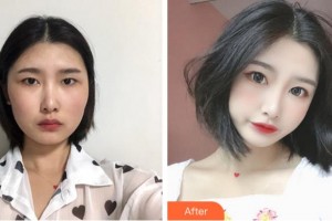 清遠(yuǎn)華美整形外科門診部劉金華整形價格表附切開雙眼皮案例展示