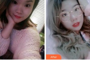 金華周亞軍口腔門診部袁云志整形價格表附牙齒隱形矯正案例展示