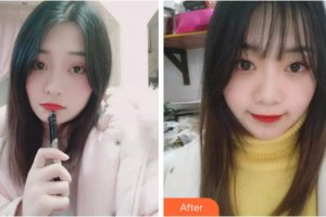 金華口腔醫(yī)院徐美丹整形價格表附牙齒隱形矯正案例展示