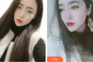 金華口腔醫(yī)院馬國強整形價格表附金屬托槽矯正案例展示