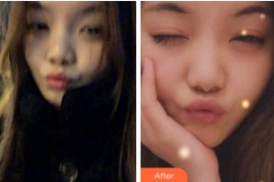 金華口腔醫(yī)院施心暢整形價格表附牙齒隱形矯正案例展示