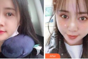 金華周亞軍口腔門(mén)診部馬永太整形價(jià)格表附自鎖托槽矯正案例展示