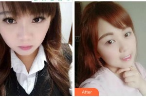 金華周亞軍口腔門(mén)診部鄒多宏整形價(jià)格表附牙齒隱形矯正案例展示