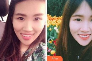 金華周亞軍口腔門(mén)診部金志平整形價(jià)格表附牙齒隱形矯正案例展示