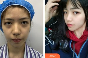 舟山沈虹醫(yī)療美容診所陸勝利整形價格表附埋線提升案例展示