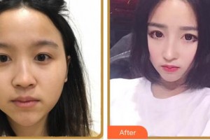 臺州市博愛醫(yī)院整形美容科唐毅整形價格表附鼻部綜合案例展示