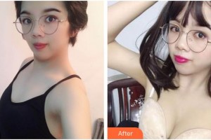 臺(tái)州市第一人民醫(yī)院醫(yī)療美容科張勇整形價(jià)格表附自體脂肪隆胸案例展示