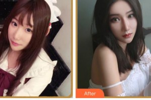 臺州國際眼科醫(yī)院黃春聯(lián)整形價(jià)格表附眼部綜合案例展示