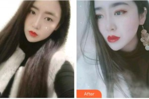 臺州康貝佳口腔醫(yī)院盛夢芽整形價格表附金屬托槽矯正案例展示