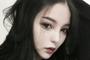 萊蕪時光整形美容醫(yī)院李開賢整形價格表附埋線提升案例展示