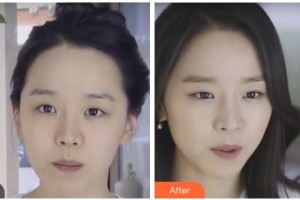 四川西嬋整形美容醫(yī)院黃琪平醫(yī)務科科長整形價格表附激光除皺案例展示