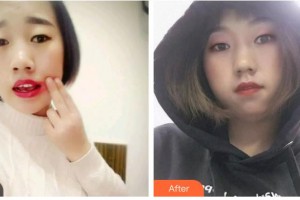 攀枝花博愛(ài)門診部楊軍整形價(jià)格表附口腔矯正案例展示