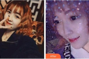 德陽維樂新橋口腔門診部孫玉楓整形價(jià)格表附超聲波潔牙案例展示