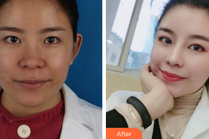 深圳新興皮膚病?？崎T診部周秋根整形價格表附皮膚管理案例展示