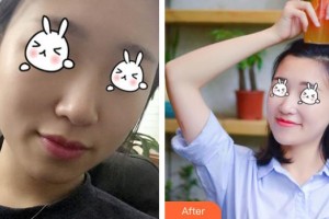 綿陽整形美容醫(yī)院任林森整形價(jià)格表附無針?biāo)獍咐故?>
</a>
<h3 class=