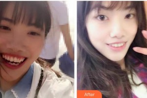 綿陽朗睿整形美容醫(yī)院梁勇生整形價(jià)格表附牙齒陶瓷矯正案例展示