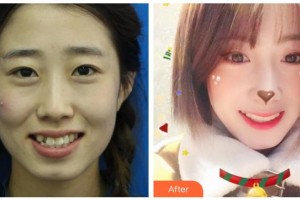 綿陽獨(dú)言口腔門診部獨(dú)言整形價(jià)格表附金屬托槽矯正案例展示