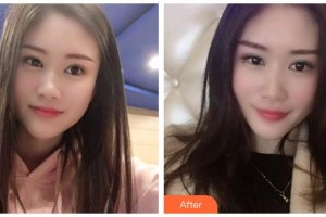 廣元口腔醫(yī)院胡澤勇整形價(jià)格表附冷光美白案例展示