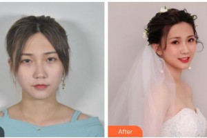 內(nèi)江市中醫(yī)醫(yī)院百合醫(yī)學(xué)美容中心薛明整形價(jià)格表附眼部綜合案例展示