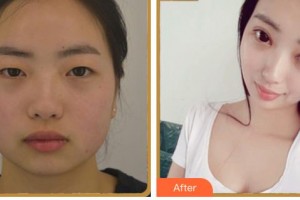 內(nèi)江韓美醫(yī)療美容門診部趙君海整形價(jià)格表附眼部綜合案例展示